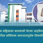 तीन महिनाका बालकको पेटमा अड्किएको हेयरपिन नर्भिकमा सफलतापूर्वक निकालियो तीन महिनाका बालकको पेटमा अड्किएको हेयरपिन नर्भिकमा सफलतापूर्वक निकालियो