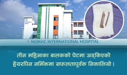 तीन महिनाका बालकको पेटमा अड्किएको हेयरपिन नर्भिकमा सफलतापूर्वक निकालियो